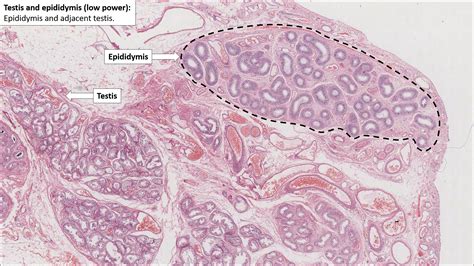 Testis And Epididymis Normal Histology Nus Pathweb Nus Pathweb