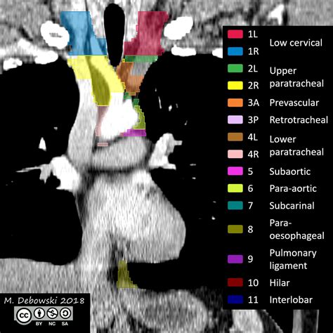 Cervical Lymph Nodes Annotated