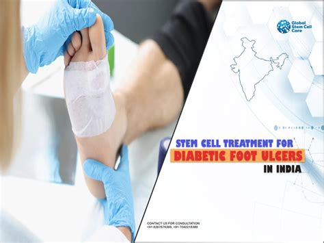 Diabetic Foot Ulcers Archives Global Stem Cell Care