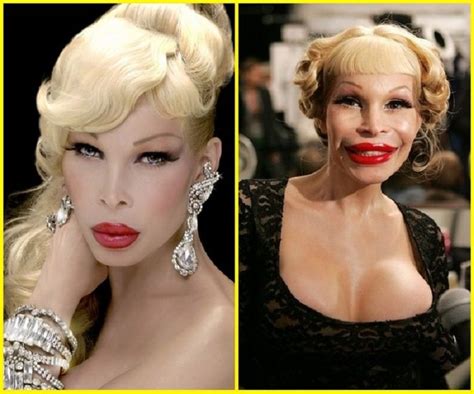 19 Celebrity Plastic Surgeries Gone Way Wrong Celebrity Plastic