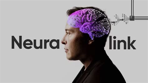 Elon Musk Asegura Que Ha Implantado El Primer Chip Cerebral En Un Ser