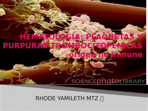 PPTX Trombocitopenia Hematologia DOKUMEN TIPS