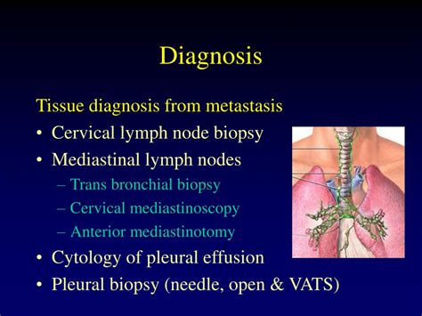 Ppt Common Thoracic Procedures Powerpoint Presentation Free Download