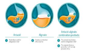 What is the difference between Antacids and Alginates? | Practice Updates