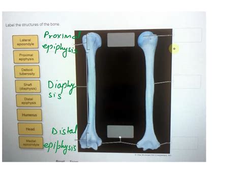 SOLVED Label The Structures Of The Bone Lateral Epicondyle Proximal