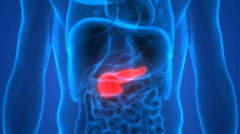 How To Early Detect Pancreatic Cancer CancerWalls