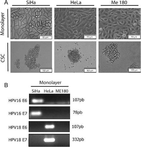 Cervical Cancer Cell Lines Morphology And Hpv Oncoproteins Expression