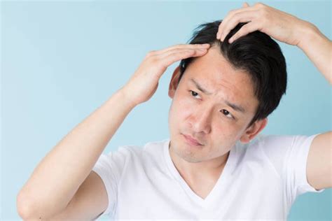 Male Hair Loss Causes Treatments And Myths Explained