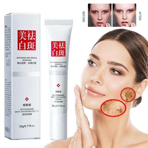 Jual Nicotinamide Spot Whitening Cream Fu Yan Whitening And Freckle