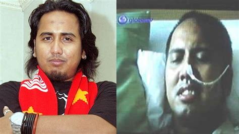 kabar  penampilan gugun gondrong  usai sempat derita