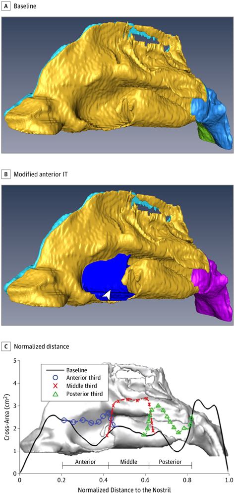 Computational Fluid Dynamics To Evaluate The Effectiveness Of Inferior