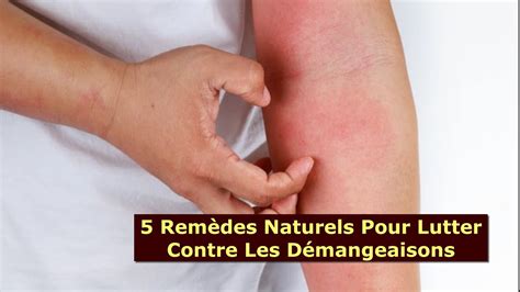 5 Remèdes Naturels Pour Lutter Contre Les Démangeaisons Youtube