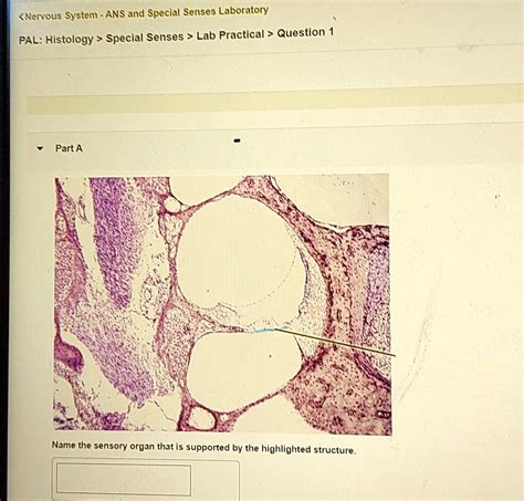 Solved Nervous System Ans And Special Senses Laboratory Pal