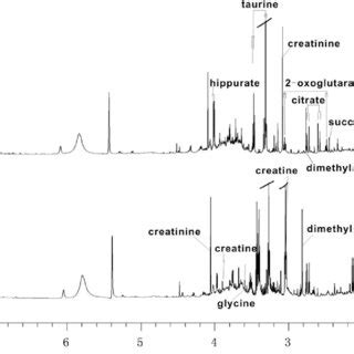 Typical 600 MHz 1 H NMR Spectra Of Urine 0 8 H Obtained From Control