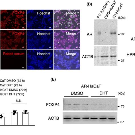 Dht Inhibits Foxp4 Expression In Ar‐transfected Hacat Cells A In The