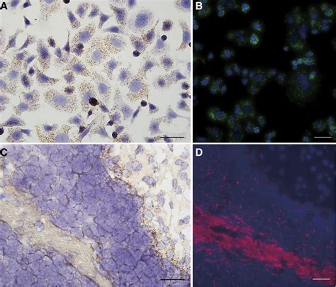 Single Molecule Chromogenic In Situ Hybridization Assay For Rna