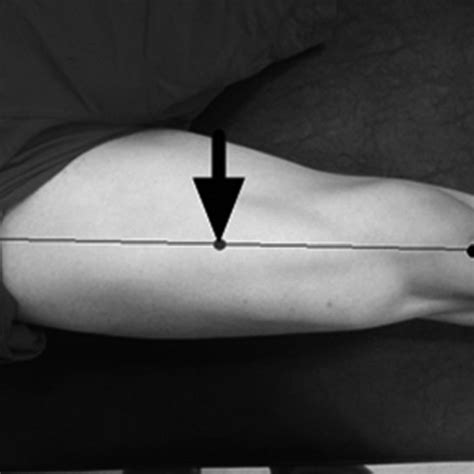 Placement Site Of Electrode On Rectus Femoris Muscle Source Personal