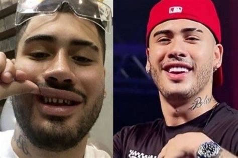 Mc Kevinho Vira Meme Na Internet Ap S Foto Sem Lente Nos Dentes Tudo