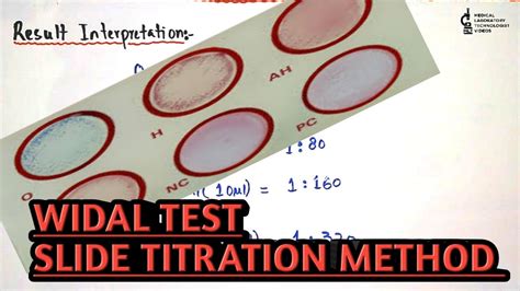 Slide Agglutination Test Procedure