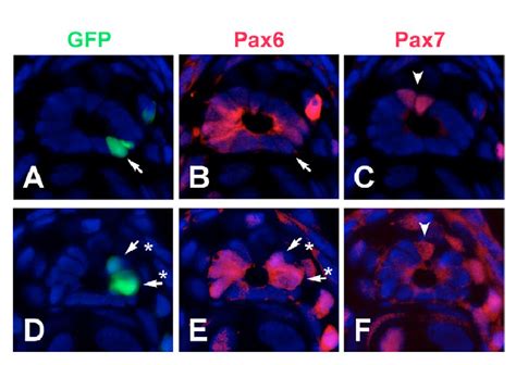 The Ventrally Derived Clone Generated Pax And Pax Daughter Cells