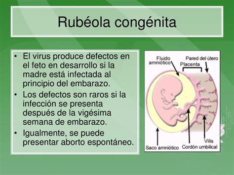 Ppt Rubéola Powerpoint Presentation Free Download Id5693828