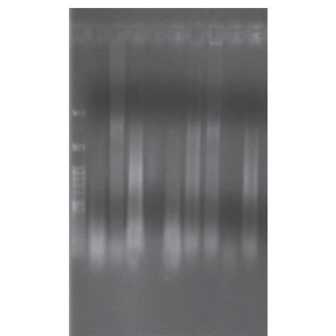 Rna Extraction Results In A 1 Agarose Gel Download Scientific Diagram