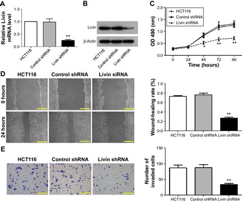 Downregulation Of Livin Inhibiting Migration And Invasion Of Hct116