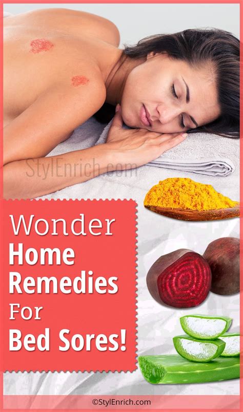 Home Remedies For Bed Sores Wonder Treatments