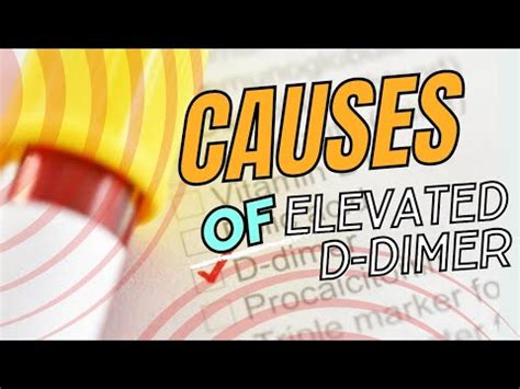 Understanding D Dimer Causes Of Elevated Levels And Implications YouTube