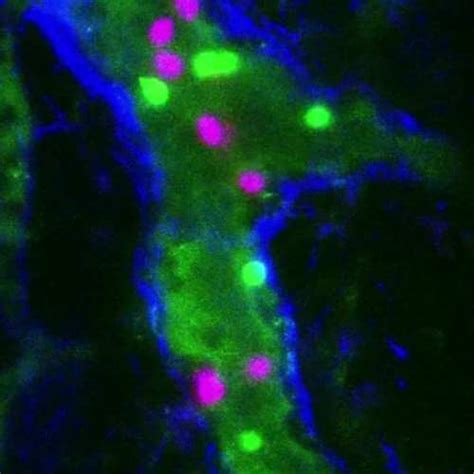 The Importance Of Integrating Intravital Microscopy With Whole Body