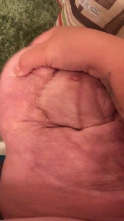 Amputee Stump Free Porntube HD Porn Video D XHamster XHamster