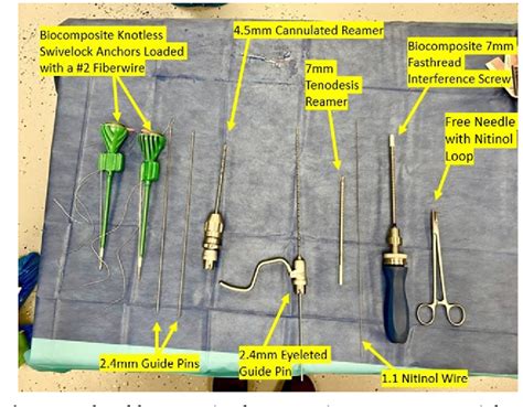 Figure 1 from Medial Patellofemoral Ligament Reconstruction: A Surgical Technique to Dynamically ...