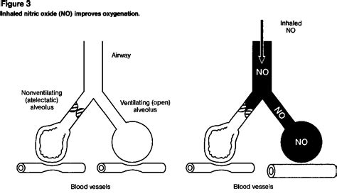 Figure 3 From Inhaled Nitric Oxide As A Selective Pulmonary Vasodilator In Clinical Anesthesia