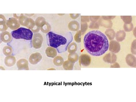 Herpesviruses. - ppt download 