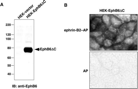 Expression And Ligand Binding Activity Of A Truncated EphB6 Receptor In