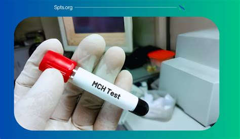 What Is The Mch Blood Test Understanding The Normal Range Health