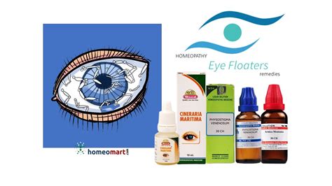 I cured my eye floaters with homeopathy remedies