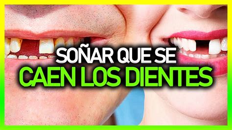 Qué significa SOÑAR QUE SE TE CAEN LOS DIENTES Significado de los