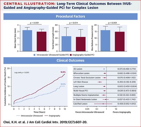 Impact Of Intravascular Ultrasound Guided Percutaneous Coronary