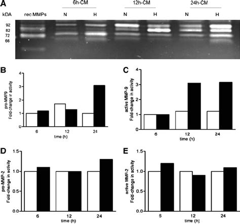 Increased Mmp 2 And Mmp 9 Activity Under Hypoxic Conditions Tem Was