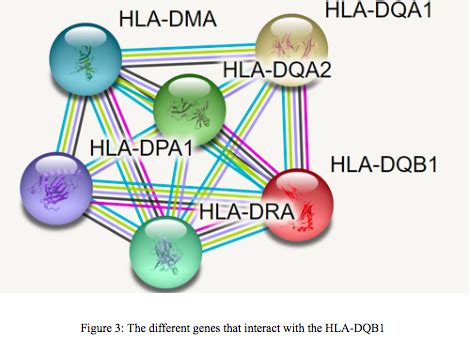 The HLA DQB1 Gene And Its Relationship With Narcolepsy NHSJS