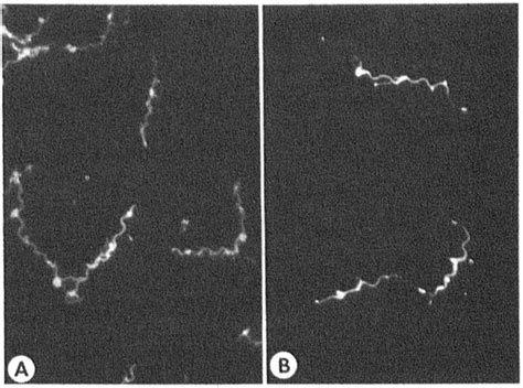 Spirochetes Isolated From The Blood Of Two Patients With Lyme Disease