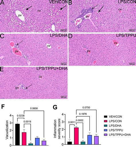 Frontiers Lipidome Modulation By Dietary Omega 3 Polyunsaturated