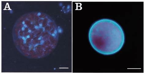 Calcofluor White Staining Protocol Uncommon Mycosis In A Patient With Diabetes Bmj Case