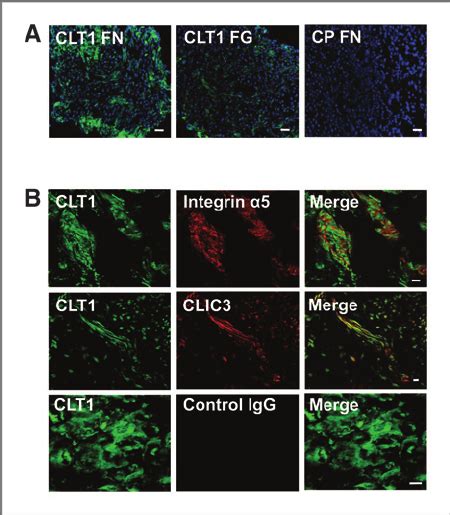 CLT1 Colocalizes With Integrin A 5 B 1 And CLIC3 In Clinical Bladder