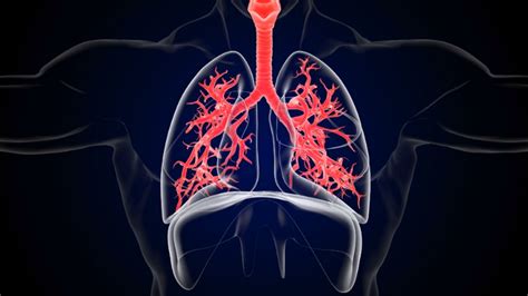 The Four Stages Of Copd Explained A Detailed Overview