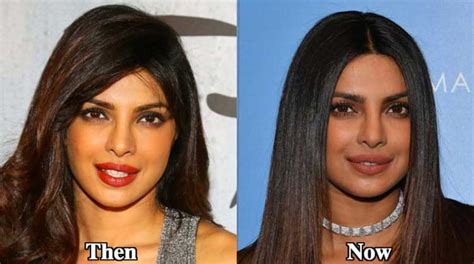 Priyanka Chopra Lips Before And After Lipstutorial Org