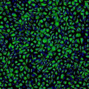 Human Non Pigmented Ciliary Epithelial Cells Innoprot Primary Cells