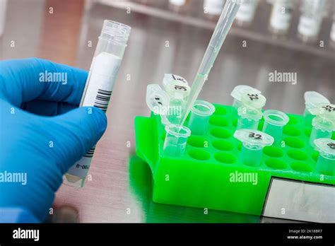 Gros Plan D Un Scientifique Qui Extrait De L Adn à L Aide De La Technique De Purification Des