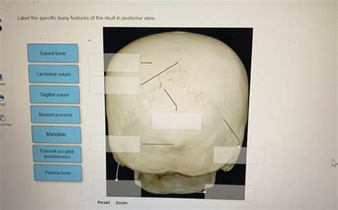 Solved Label The Specific Bony Features Of The Skull In